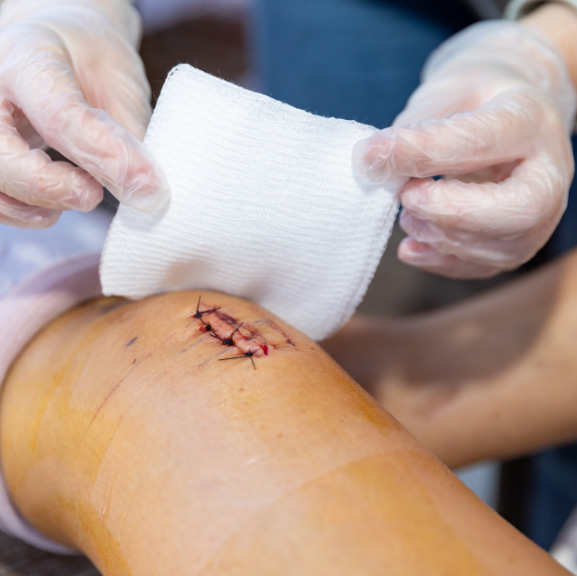 Soins de plaies : comment gagner en efficacité sans compromettre la qualité ?